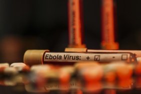 DSÖ: KDC'deki Ebola salgınında genel risk çok yüksek