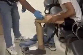Protez bacağından 830 gram uyuşturucu çıktı 6 Protez bacağından 830 gram uyuşturucu çıktı