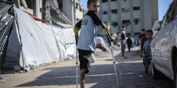 Euro-Med: Gazze'de 3 yıllık soykırımda 10 binden fazla çocuk uzuv kaybı yaşadı 7 Euro-Med: Gazze'de 3 yıllık soykırımda 10 binden fazla çocuk uzuv kaybı yaşadı