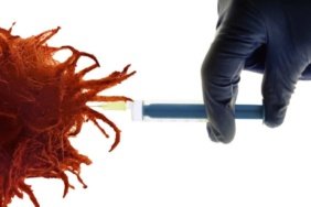 Kişiselleştirilmiş mRNA aşı tedavisi cilt kanserinde nüks riskini düşürüyor