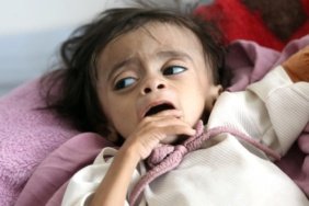 BM: Yemen'de insani felaket derinleşiyor, hareketsizlik can alıyor