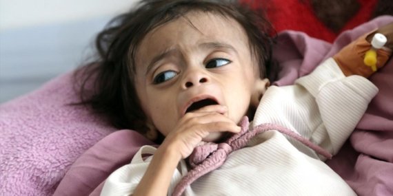BM: Yemen'de insani felaket derinleşiyor, hareketsizlik can alıyor 7 BM: Yemen'de insani felaket derinleşiyor, hareketsizlik can alıyor